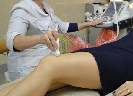 УЗД колінного суглоба м’яких тканин та судин гомілки